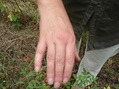 #8: The hornet stung hand