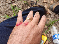 #10: Machuquei a m&atilde;o ao escorregar e cair - I hurted the hand when I slip and fell down