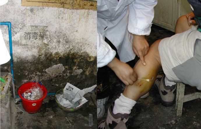Larry's dog bite being checked out on day one; in a filthy room in the village clinic - both pictures were taken from the same spot