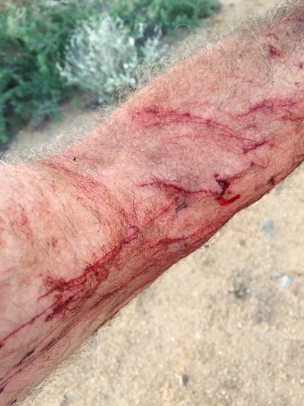 My left arm, after tripping and falling into a barrel cactus during my hike back down from the confluence point