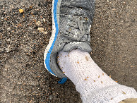#11: These took several days to pick out of my socks. 